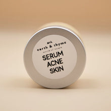 Load image into Gallery viewer, Croc Oil Serum - Acne Skin 15 mls